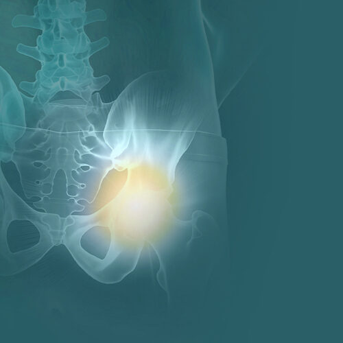 Pelvic Health